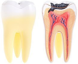 Dental Abscess | Dentist Preston